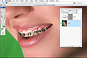 Removing Braces in Photoshop